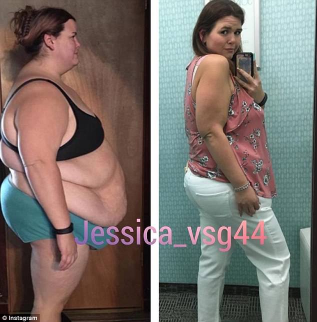 Almost there: She is currently in the process of losing the last 38-48 lbs before getting a tummy tuck